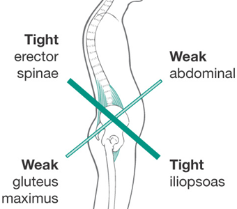 tight hip flexors