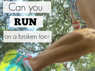 Can you run on a broken toe? Find out what to do for a toe injury and when not to run