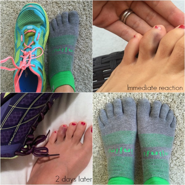 running toe pain