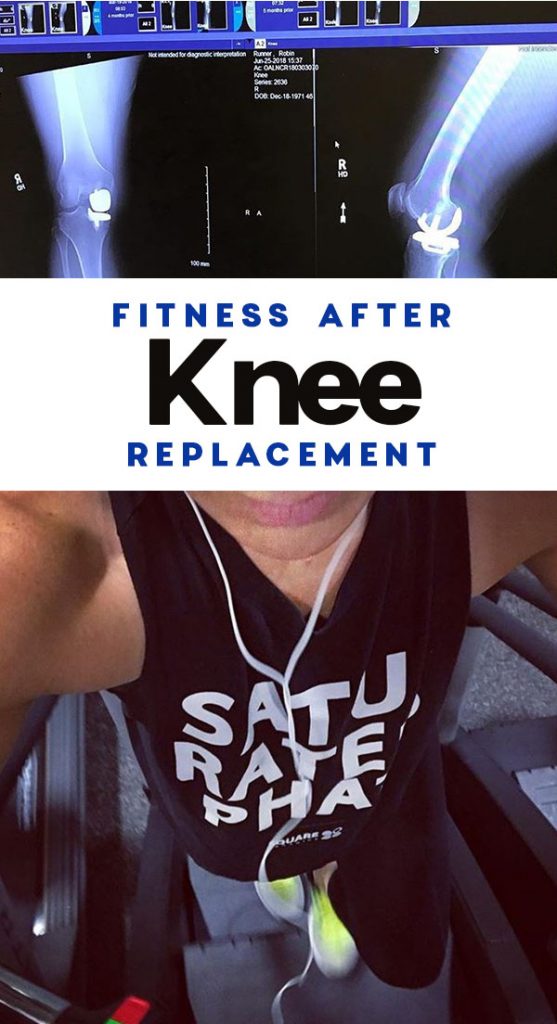 Running After Knee Replacement Surgery Fitness Tips & Answers