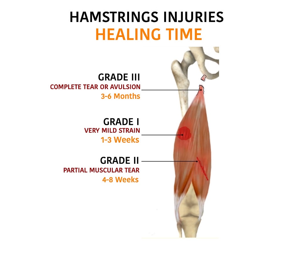 Hamstring Injury Recovery