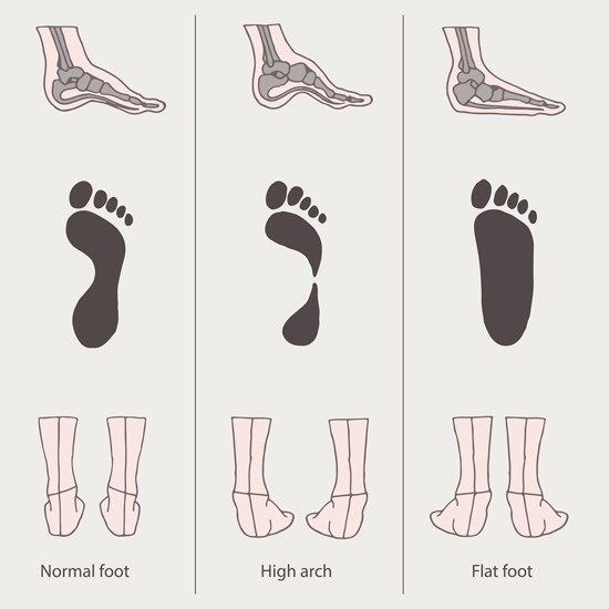 Flat feet running shoes