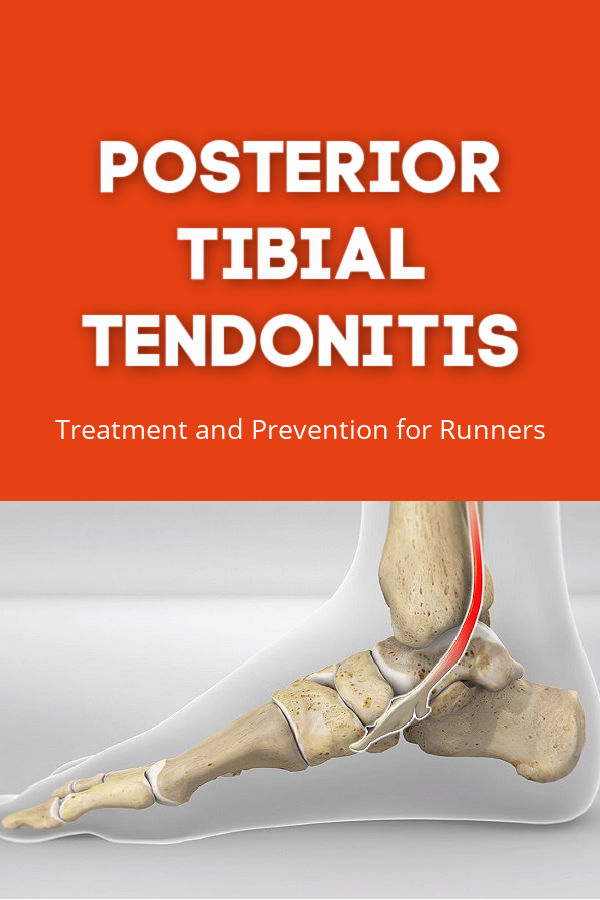 Posterior Tibial Tendonitis Running