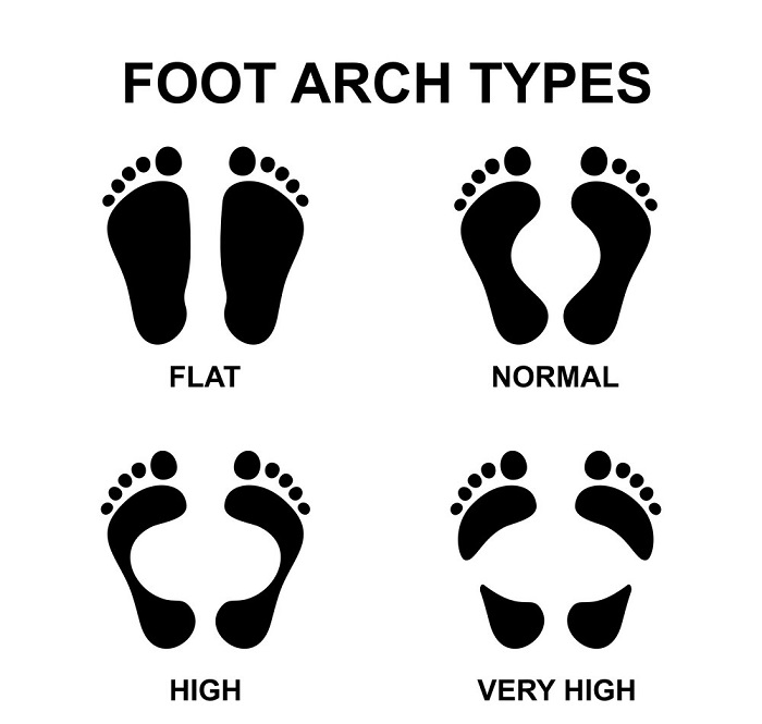 High arches running shoes