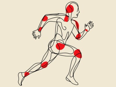 running with rheumatoid arthritis