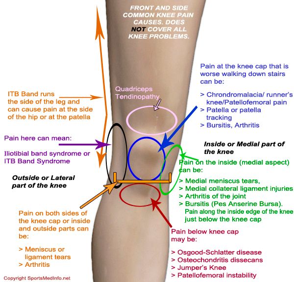Running Knee Pain Causes