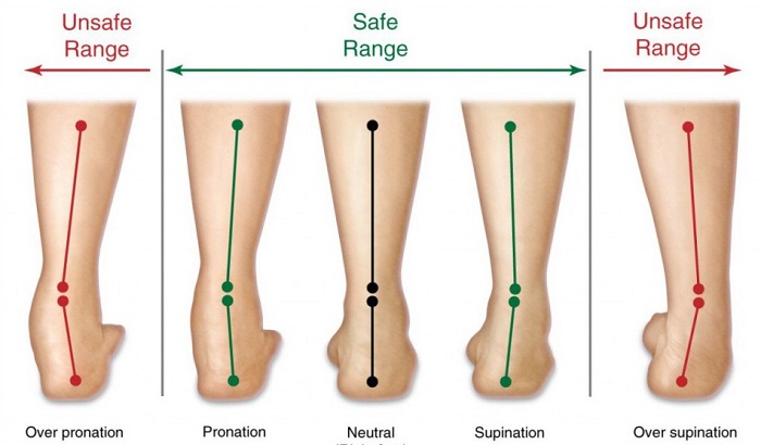 Over-Supination Explained