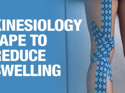 kinesiology tape for swelling