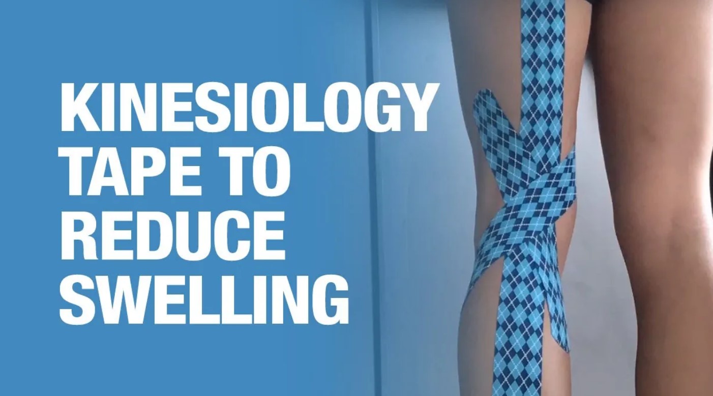 How to Use Kinesiology Tape to Reduce Swelling (Video)